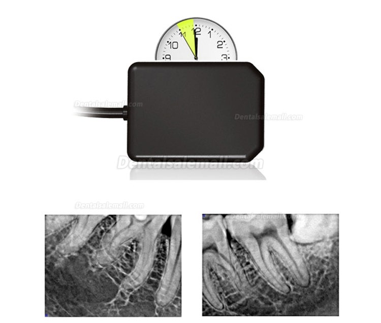 High Resolution Digital USB Type Dental X Ray Sensor Rvg HDR 500
